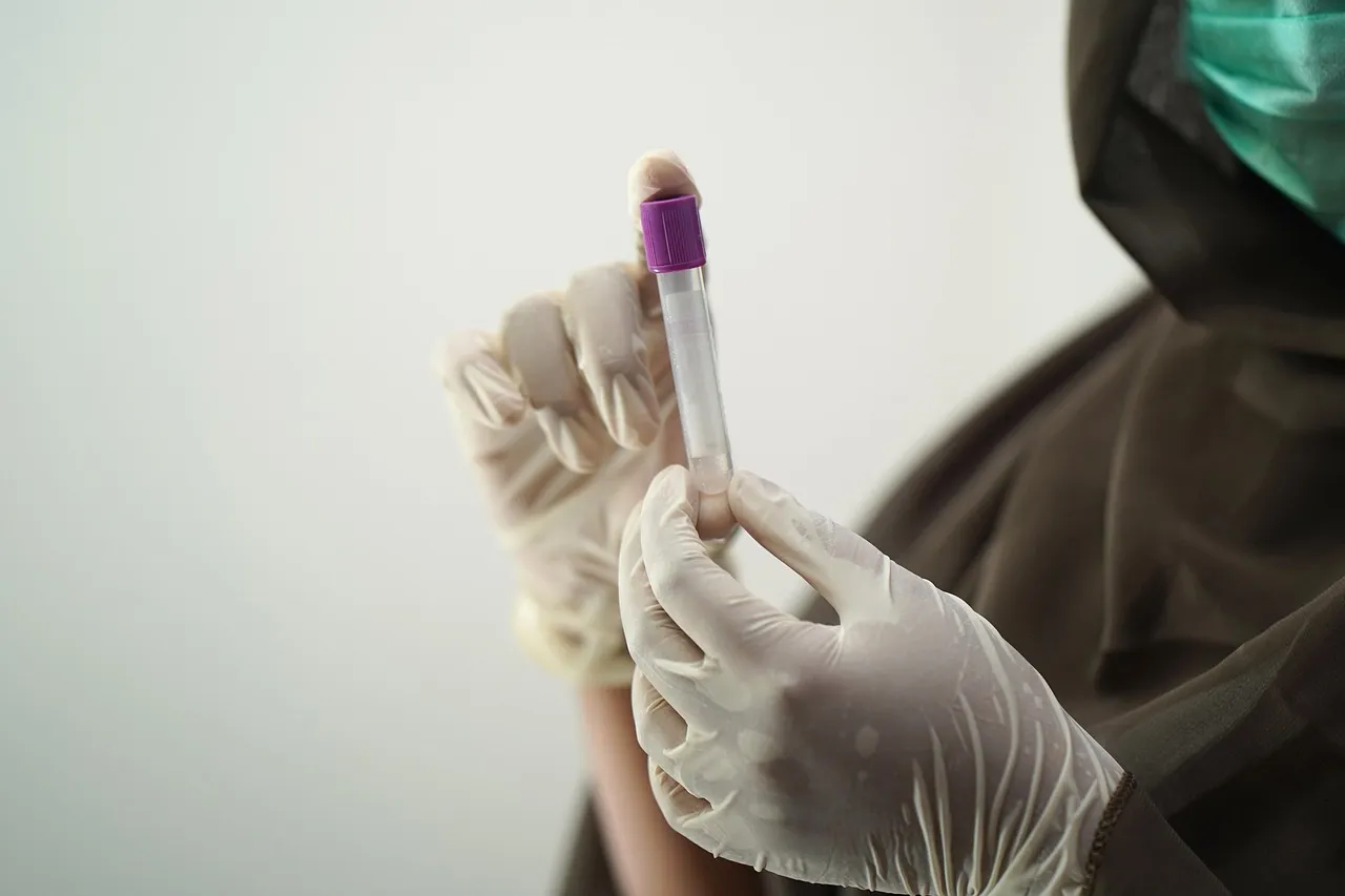 Vials of blood samples being handled by a lab technician for diagnostic testing