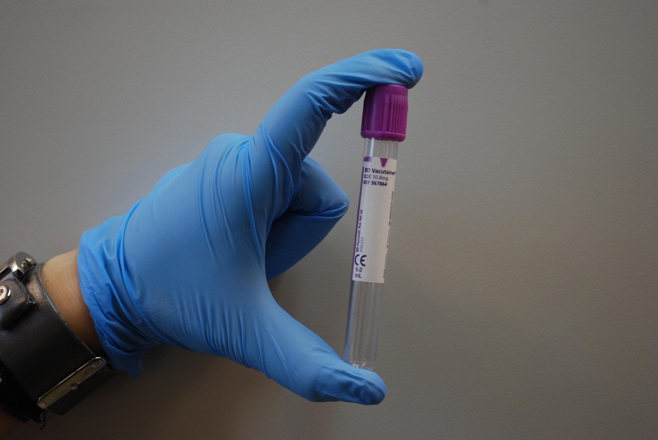 Lab, medical, diagnostics — illustrating GLOW Blend (GHK-Cu + BPC-157 + TB-500) Dosing