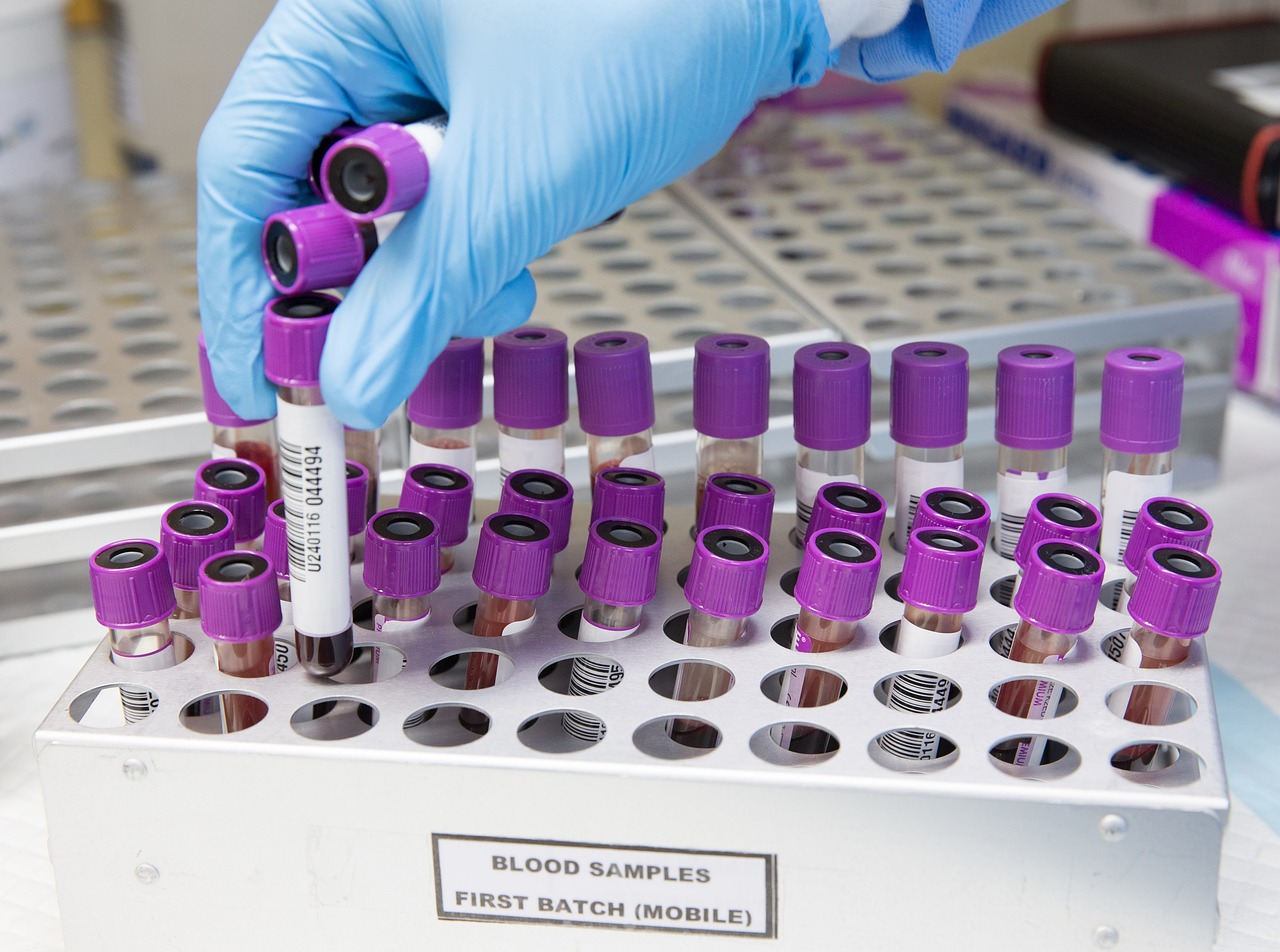 Sample, lab, laboratory — illustrating How Much Bacteriostatic Water to Add to a Peptide Vial