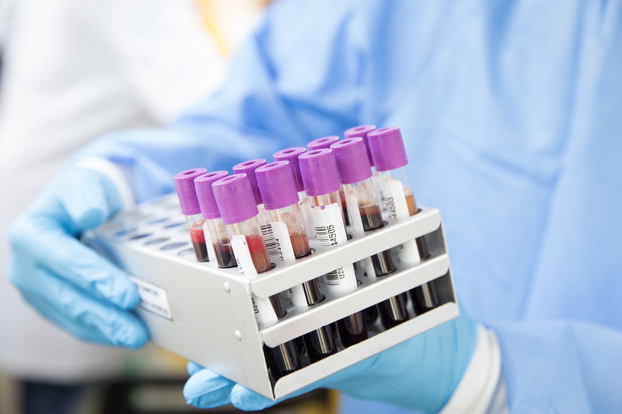 Sample, lab, laboratory — illustrating Melanotan I vs Melanotan II: Comparing the Tanning Peptides