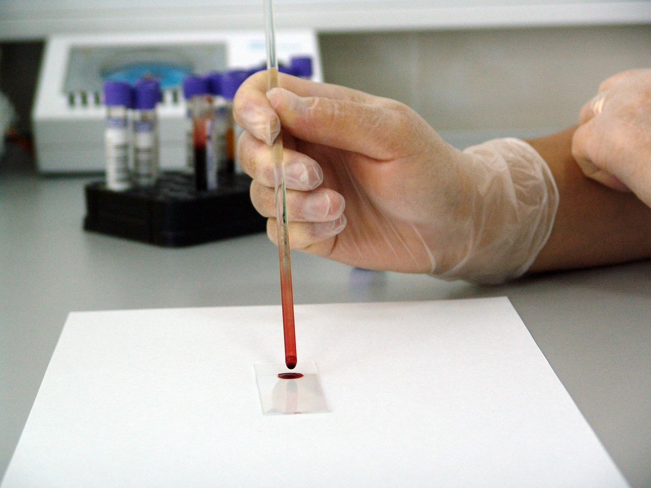 Sample, lab, laboratory — illustrating DIY Peptide Blend: Mixing Two Vials Into One