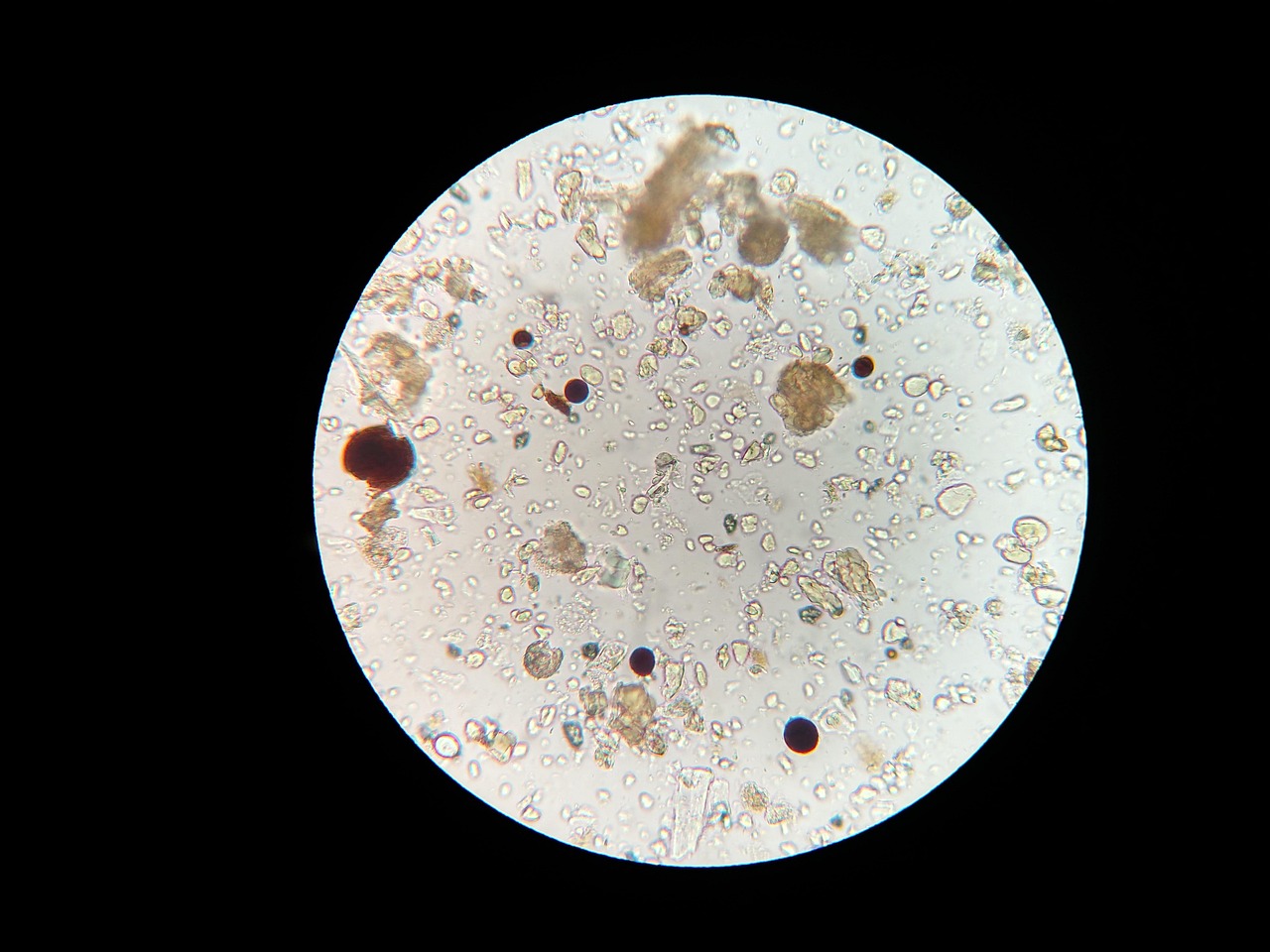 Soil microbes, microscope, soil sample — illustrating Senescence and Inflammaging
